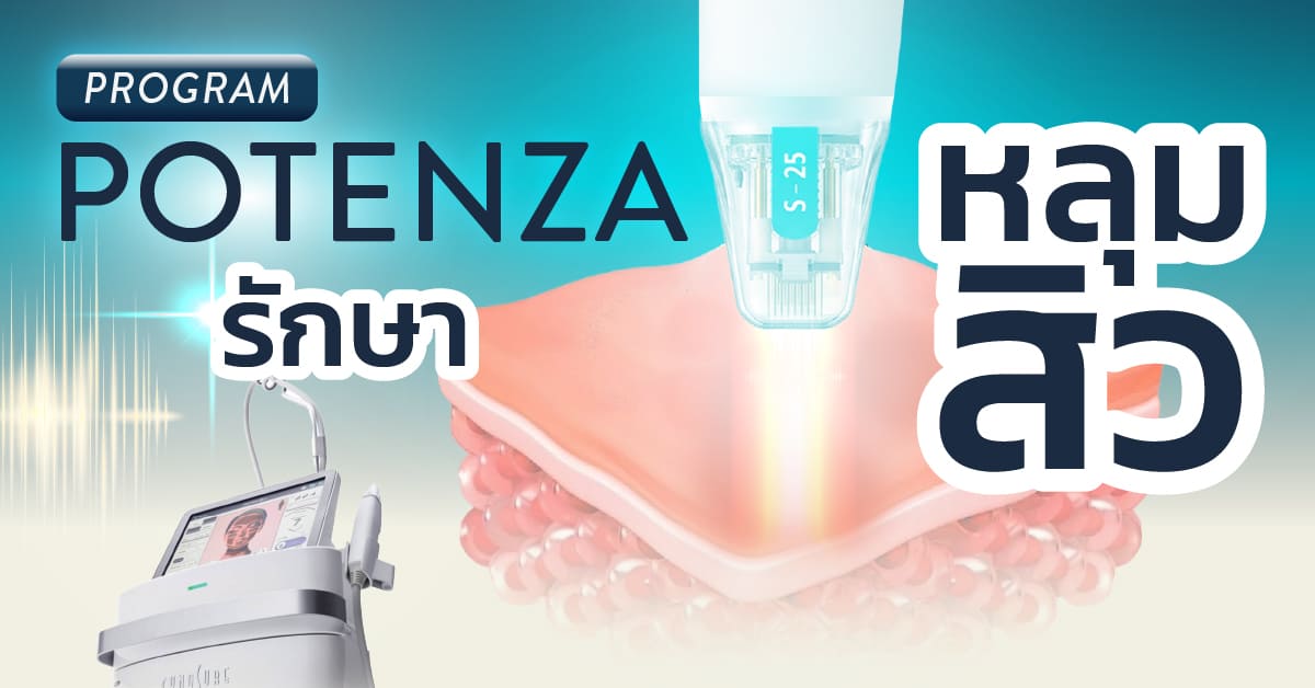 AW-SKYN-AcneProgram_Artboard 1