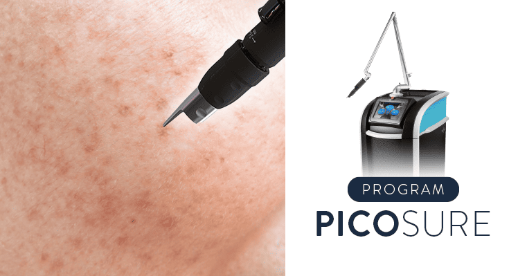 AW-SKYN-Service-Icon-PicoSure+