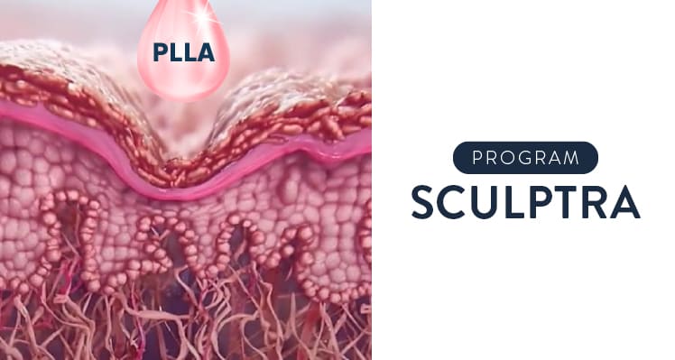 AW-SKYN-Service-TN-Sculptra