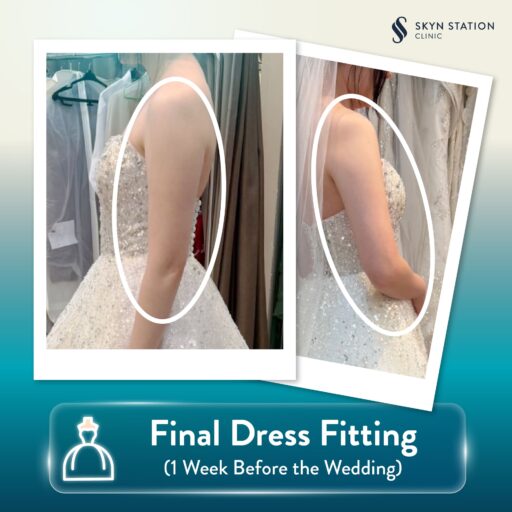 AW-SKYN-Slim-Arms-for-Bride-Content3-EN