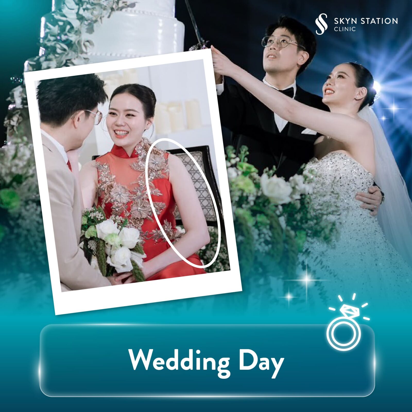 AW-SKYN-Slim-Arms-for-Bride-Content4-EN