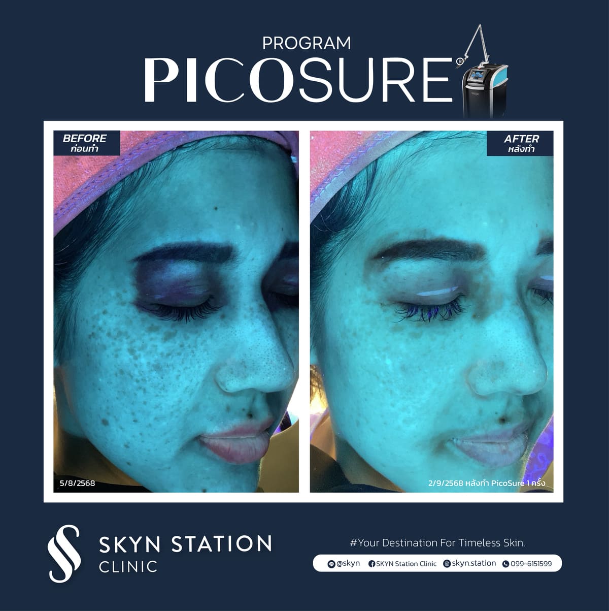 Review-Picosure-November-2025 (10)