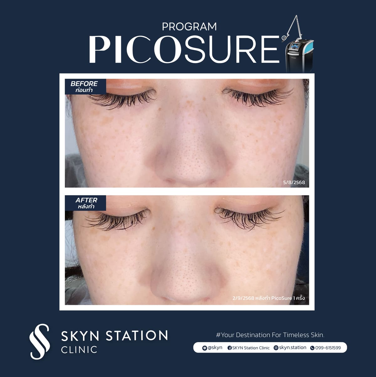 Review-Picosure-November-2025 (11)