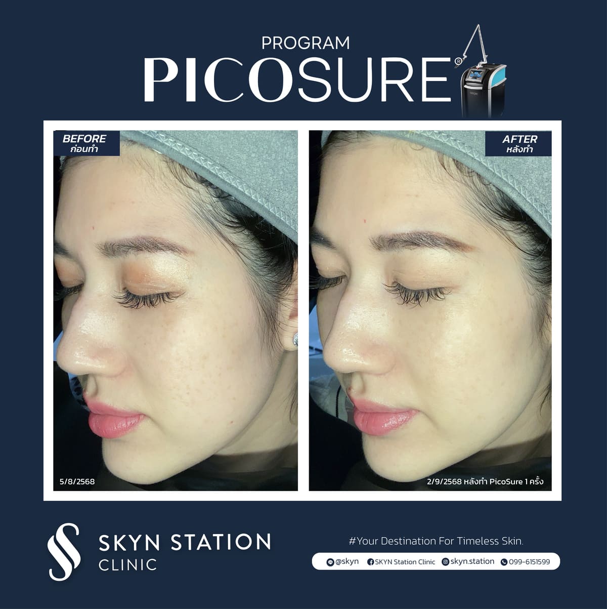 Review-Picosure-November-2025 (12)