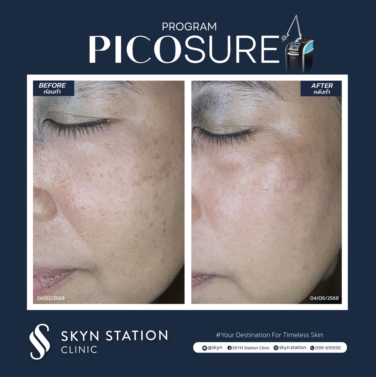 Review-Picosure-November-2025 (2)