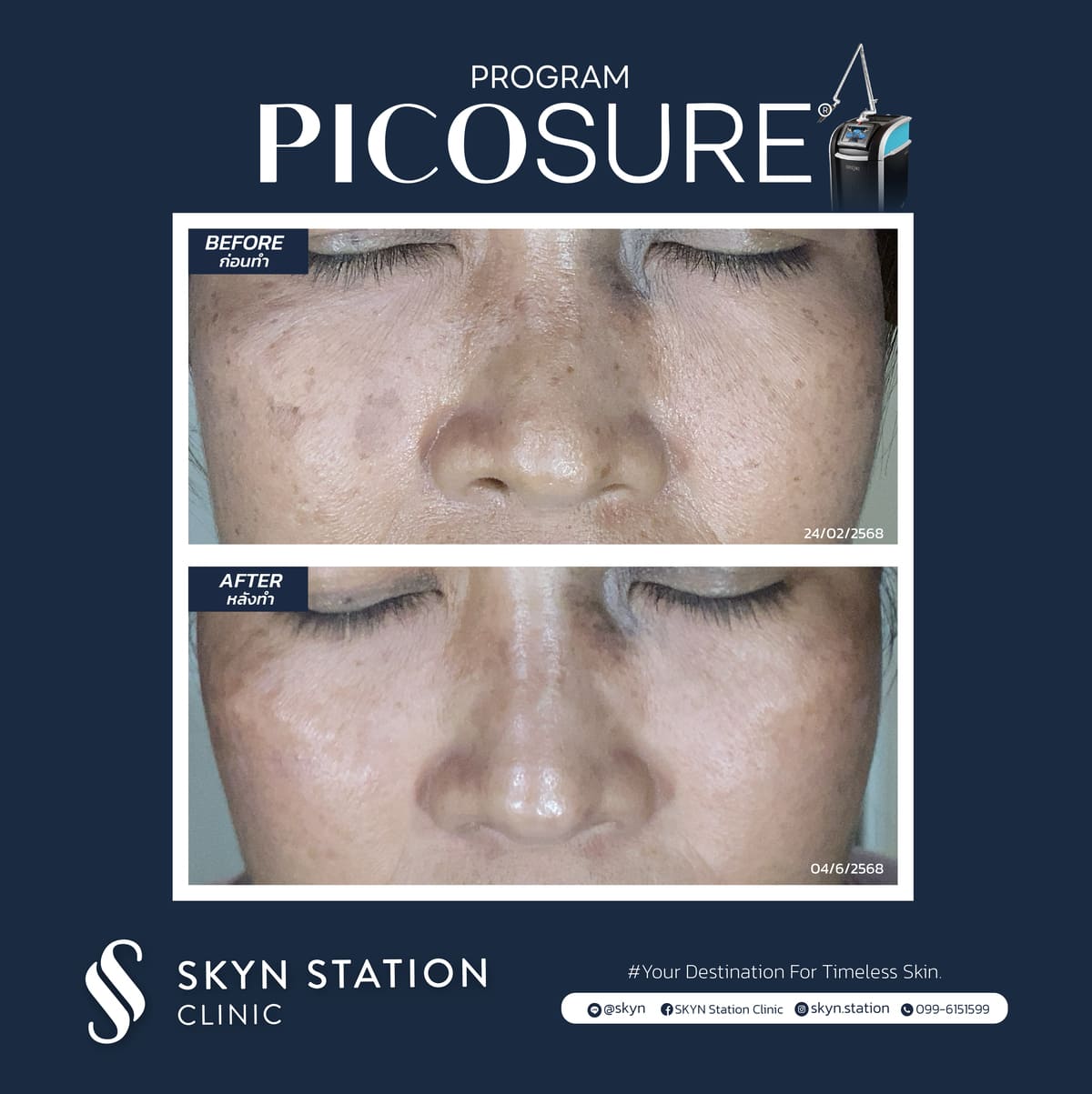 Review-Picosure-November-2025 (4)