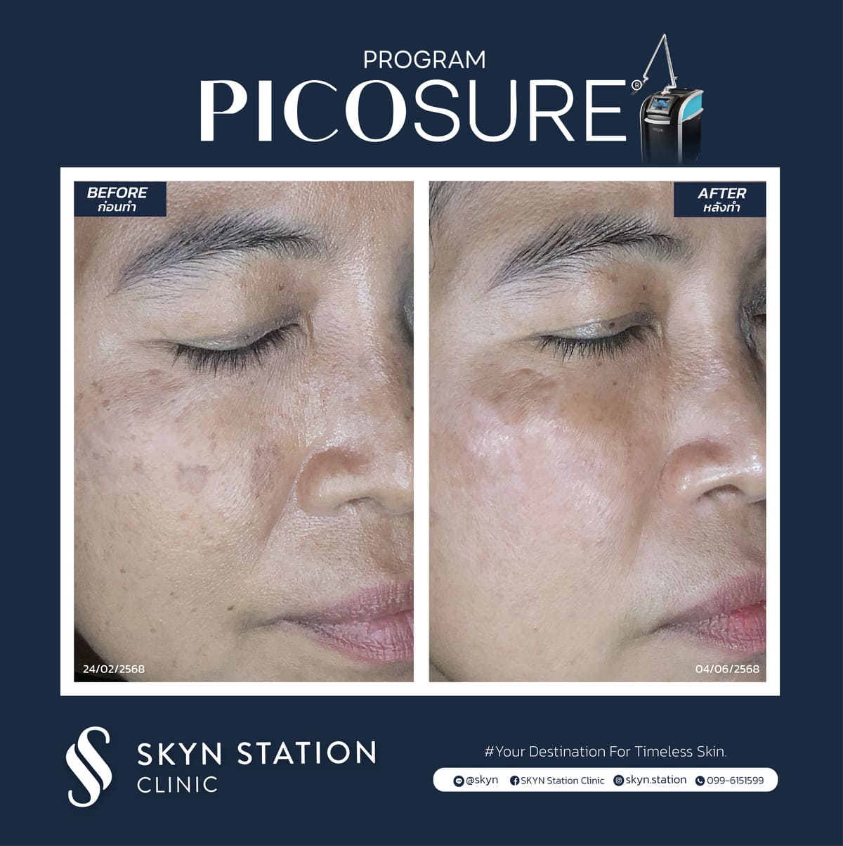 Review-Picosure-November-2025 (5)