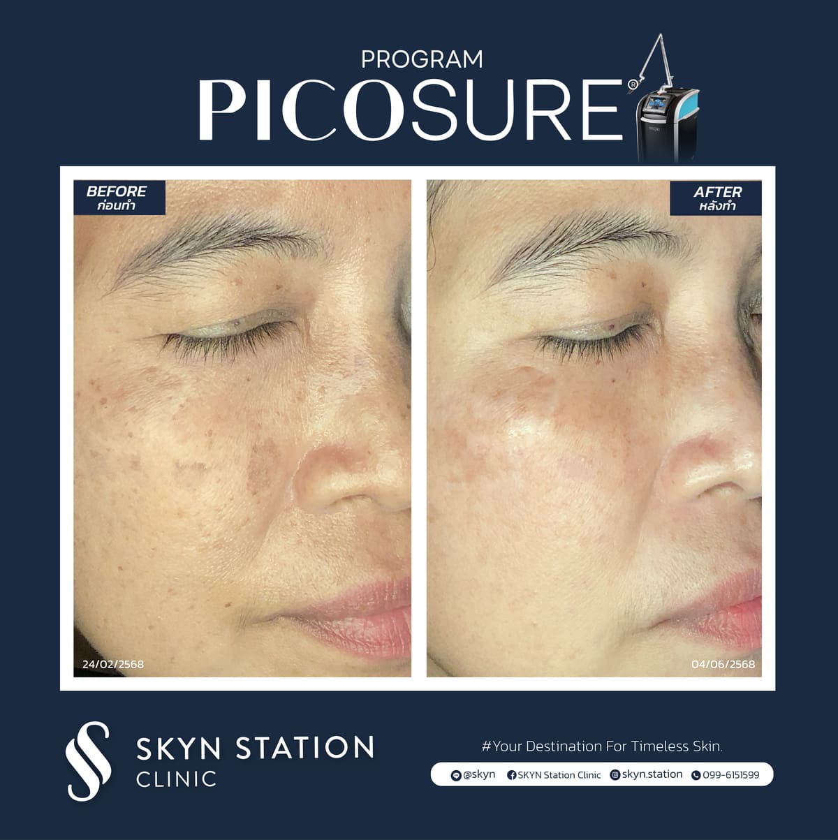 Review-Picosure-November-2025 (7)