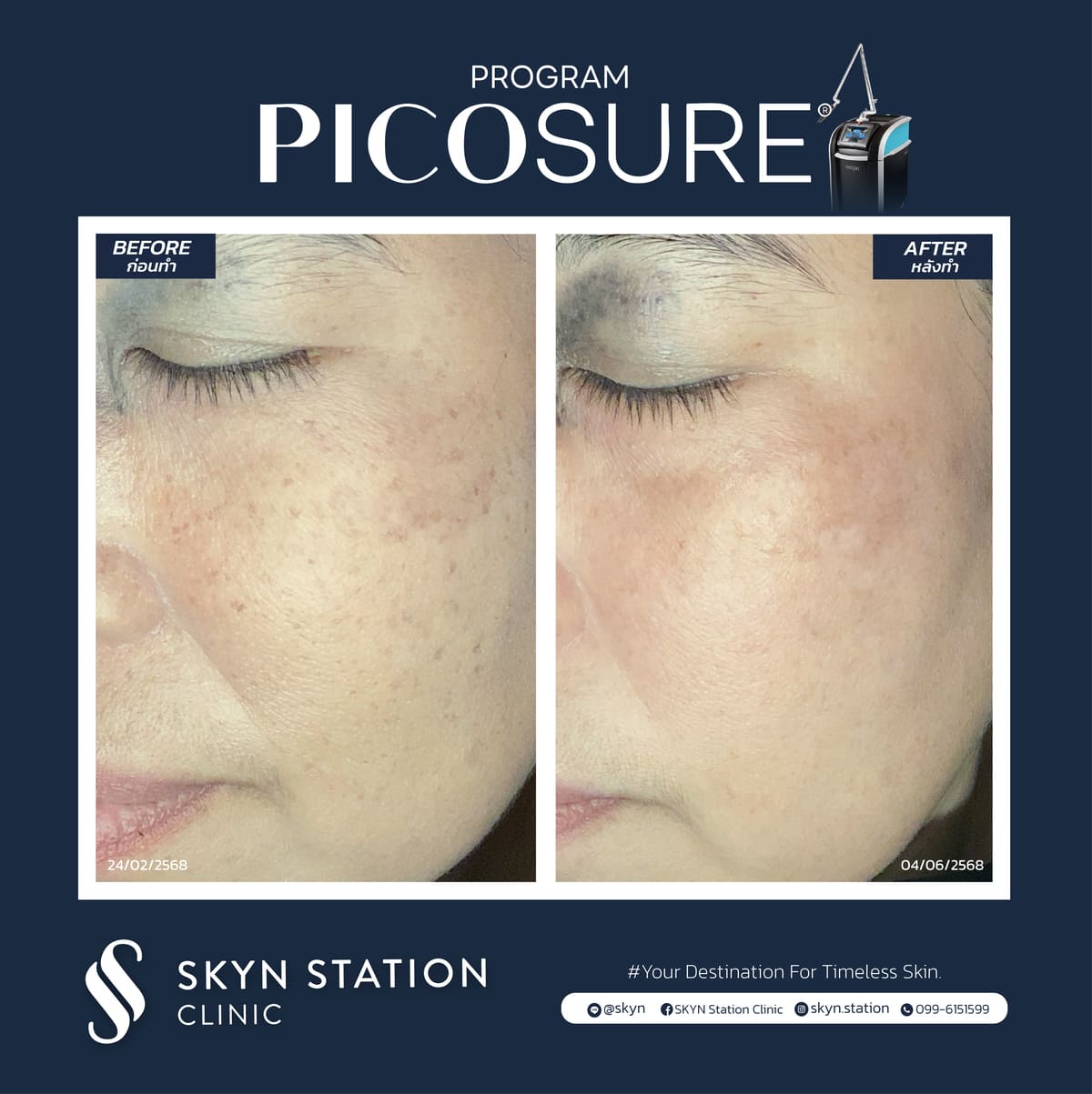 Review-Picosure-November-2025 (8)