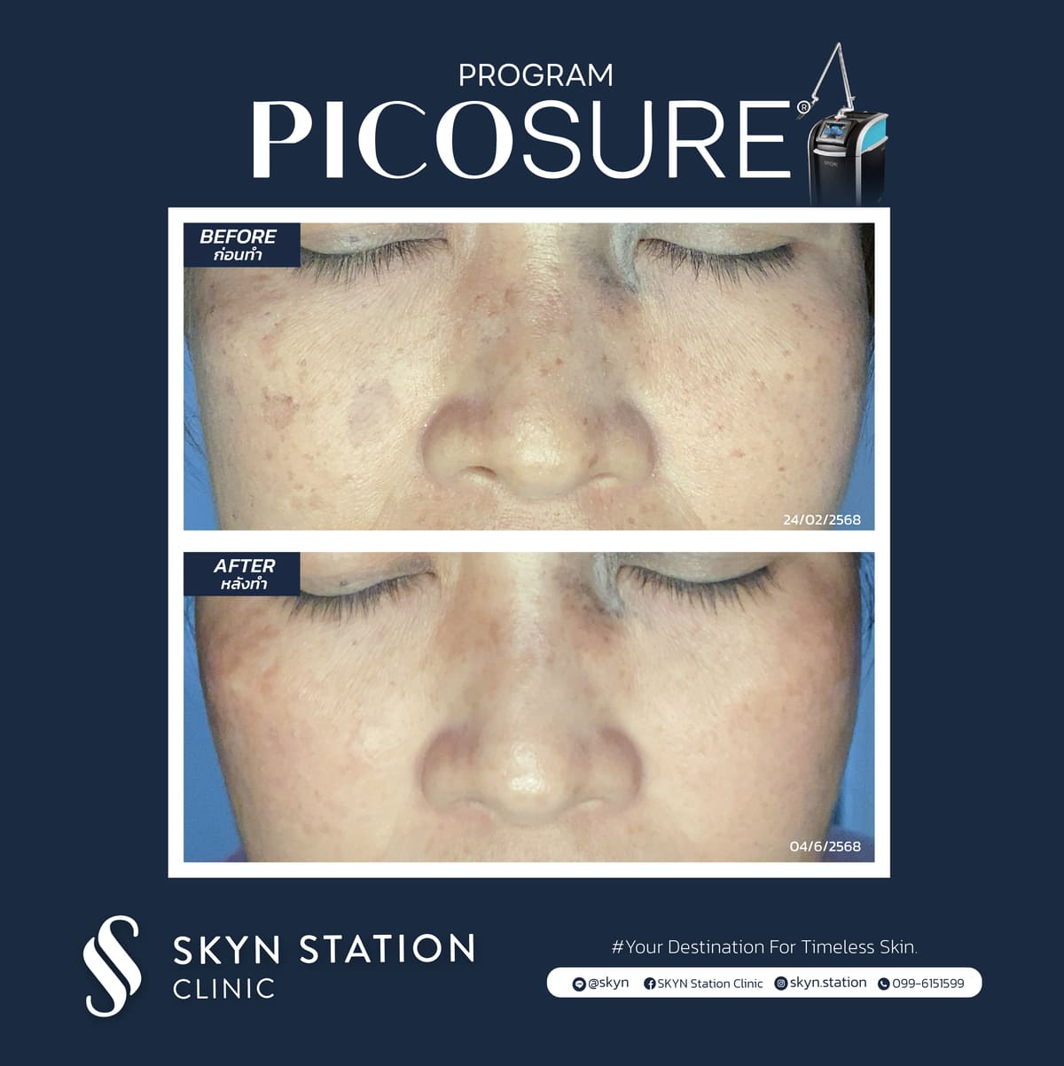 Review-Picosure-November-2025 (9)