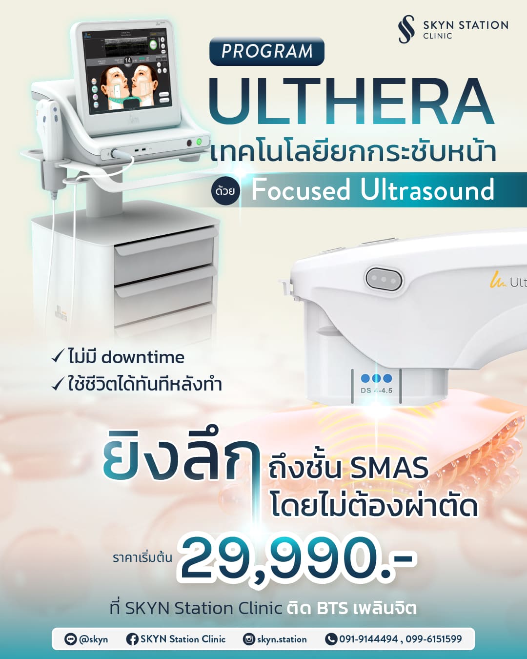 aw-skyn-article-ulthera-01