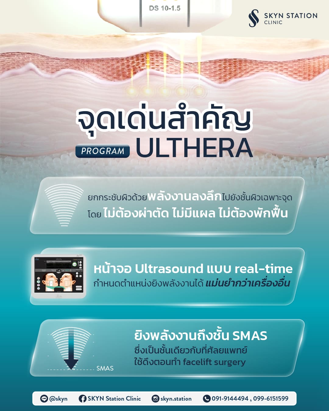 aw-skyn-article-ulthera-02