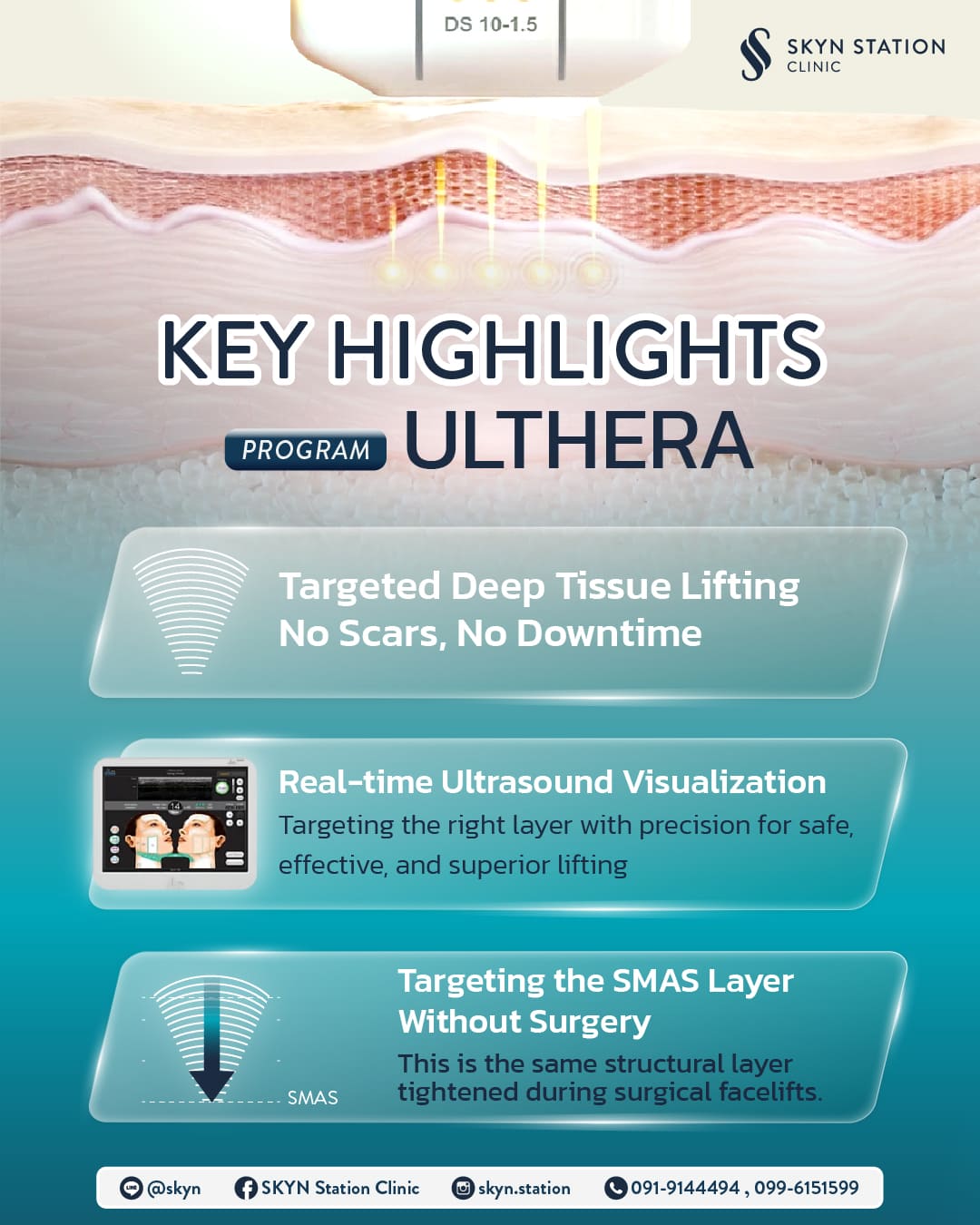 aw-skyn-article-ulthera-EN-02